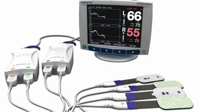 cerebral oximeter