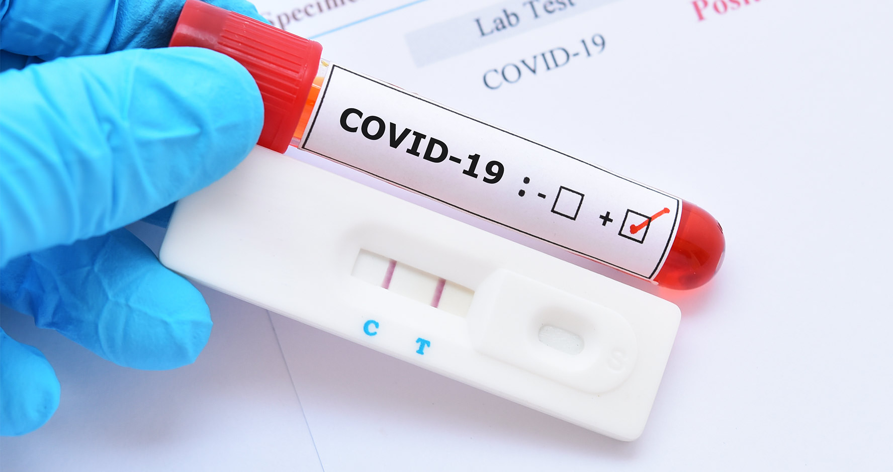 RT-PCR Test