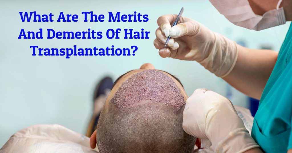 hair transplant cost -What Are The Merits And Demerits Of Hair Transplantation?