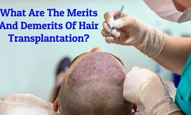 hair transplant cost -What Are The Merits And Demerits Of Hair Transplantation?