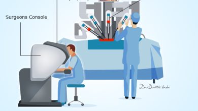 robotic surgery