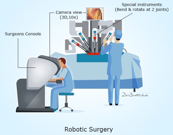 robotic surgery