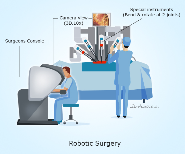 robotic surgery