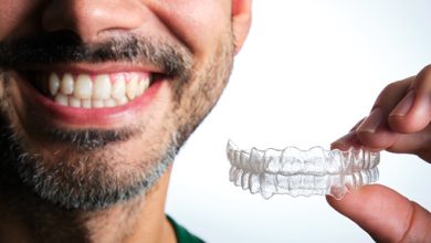 invisalign dentaire laval