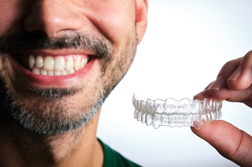 invisalign dentaire laval