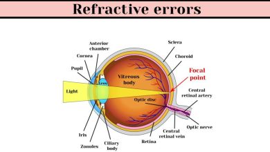 Refractive Errors - Featured Image